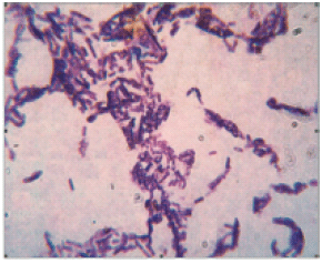 Bacillus Coagulans