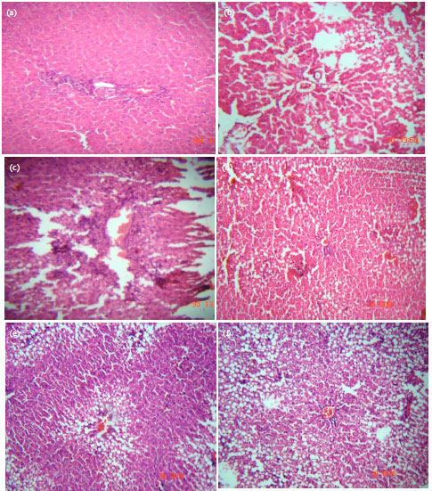 Image for - Hepatoprotective Activity of Fumaria officinalis against CCl4-induced Liver Damage in Rats