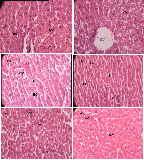 Image for - Hepatoprotective Activity of Rohitaka ghrita against Paracetamol Induced Liver Injury in Rat