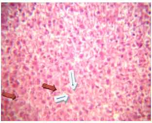 Image for - Possible Histological Changes Induced by Therapeutic Doses of Ciprofloxacin in Liver and Kidney of Juvenile Rats
