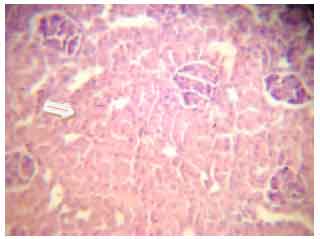 Image for - Possible Histological Changes Induced by Therapeutic Doses of Ciprofloxacin in Liver and Kidney of Juvenile Rats