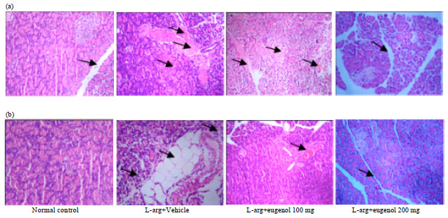 Image for - Ameliorating Effect of Eugenol on L-arginine Induced Acute Pancreatitis and Associated Pulmonary Complications in Rats