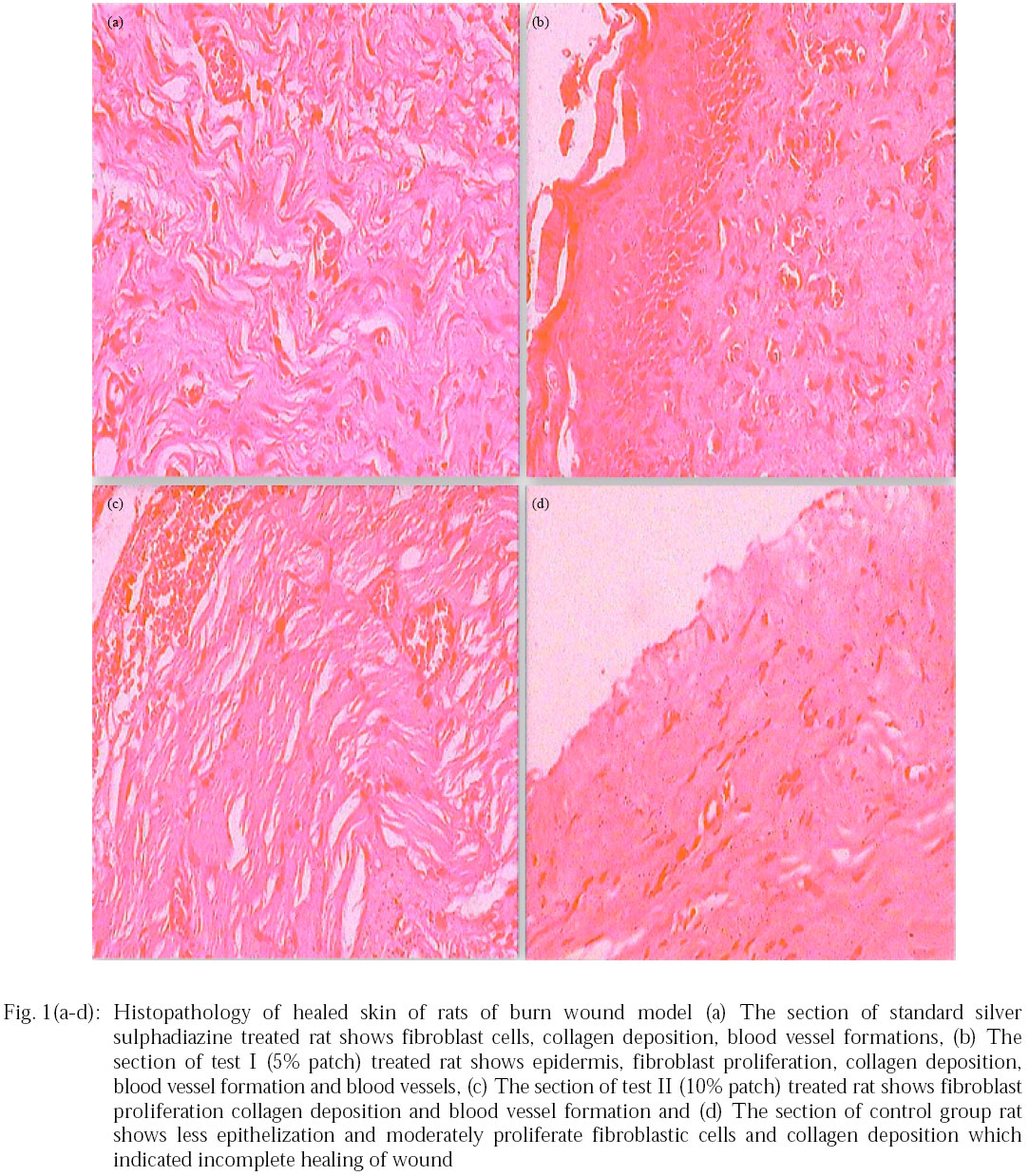 Image for - Effect of Transdermal Patch of Ficus racemosa Leaves Extract on Dermal Burn Wound