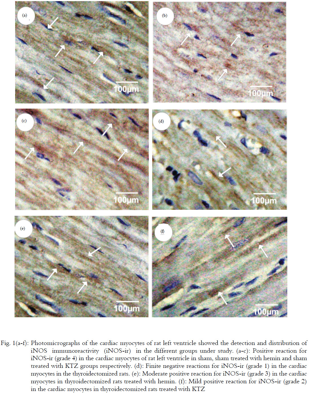 Image for - Interrelationship of Heme Oxygenase and the Oxidative Stress in the Cardiac  Tissues of Thyroidectomized Rats