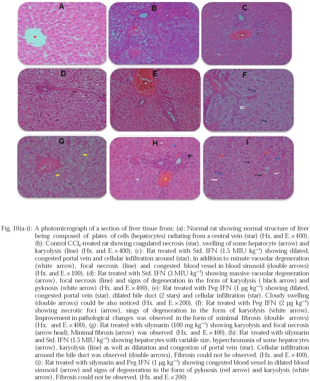 Image for - Pegylated Interferon Versus Standard Interferon and Silymarin in Treatment of Liver Fibrosis Induced by Chronic Carbon Tetrachloride in Rats