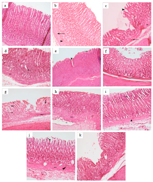 Image for - Impact of the Dopaminergic System on Mucosal Integrity in Indomethacin-induced Gastric Ulcers in Rats: Possible Modulation by Ranitidine or L-carnitine