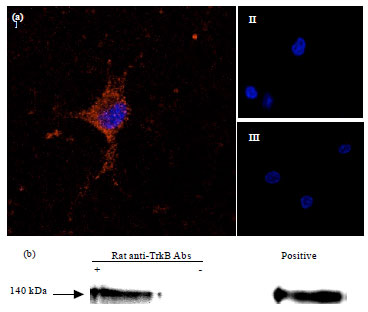 Image for - Anti-trkb Antibodies as Pharmacological Tools to Study the Function of the Trkb Receptor and its Role in the Regulation of Food Intake