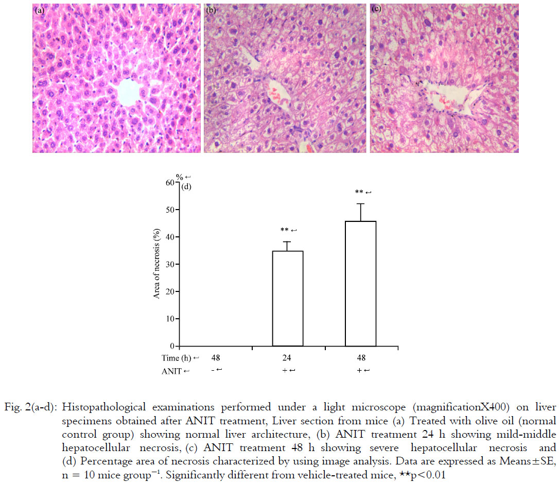 Image for - Acid-sensing Ion Channels Expression in Liver of Cholestatic Liver Injury  Mice