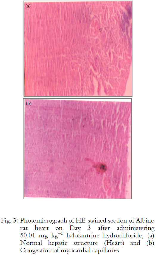 Image for - Toxicological Effect of Sub-therapeutic, Therapeutic and Overdose Regimens of Halofantrine Hydrochloride on Male Albino Rats