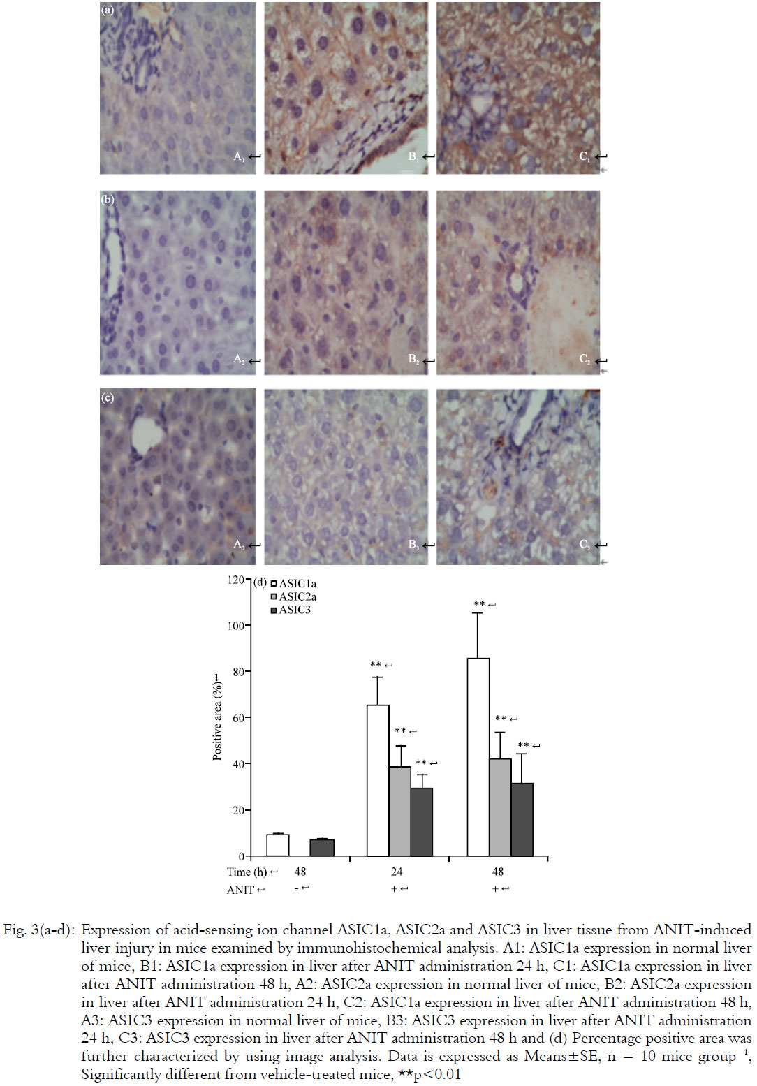 Image for - Acid-sensing Ion Channels Expression in Liver of Cholestatic Liver Injury  Mice
