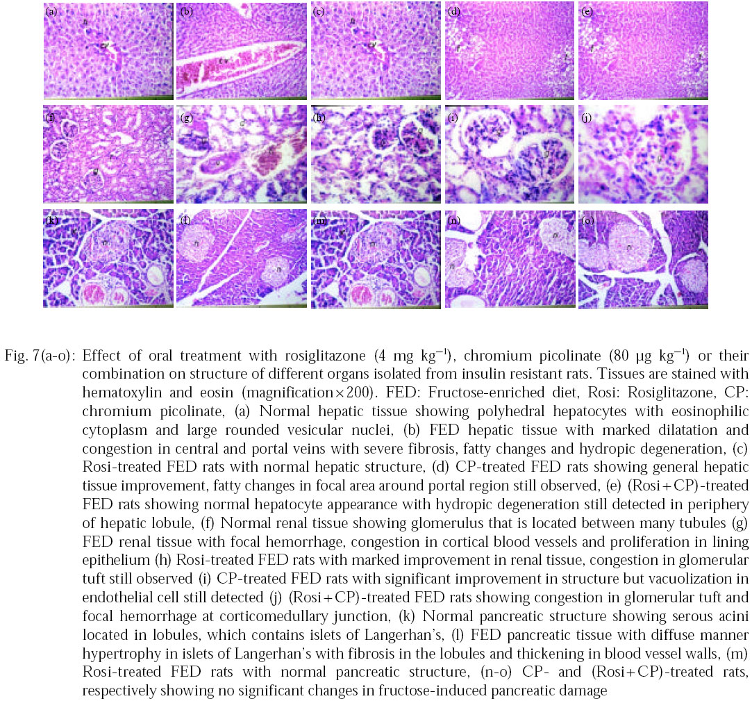 Image for - Chromium Picolinate and Rosiglitazone Improve Biochemical Derangement in a Rat Model of Insulin Resistance: Role of TNF-α and Leptin