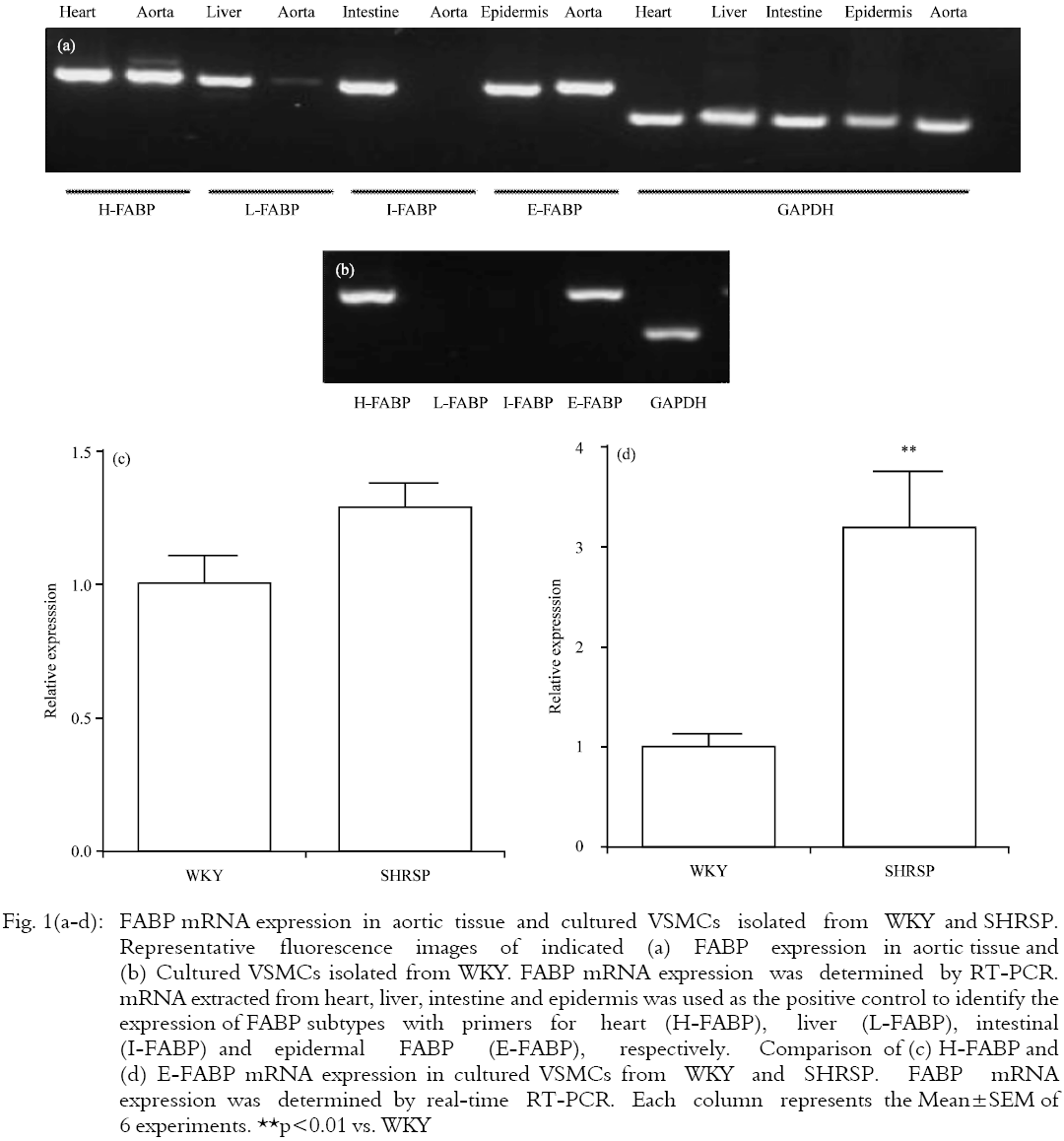 Image for - Comparison of Fatty Acid-binding Protein Expression in Vascular Smooth Muscle Cells from Stroke-prone Spontaneously Hypertensive and Wistar Kyoto Rats