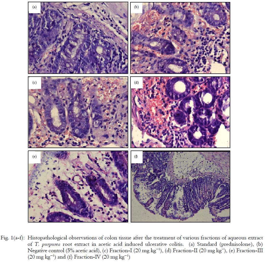 Image for - Glycoside from Tephrosia purpurea Roots in the Treatment of Ulcerative  Colitis