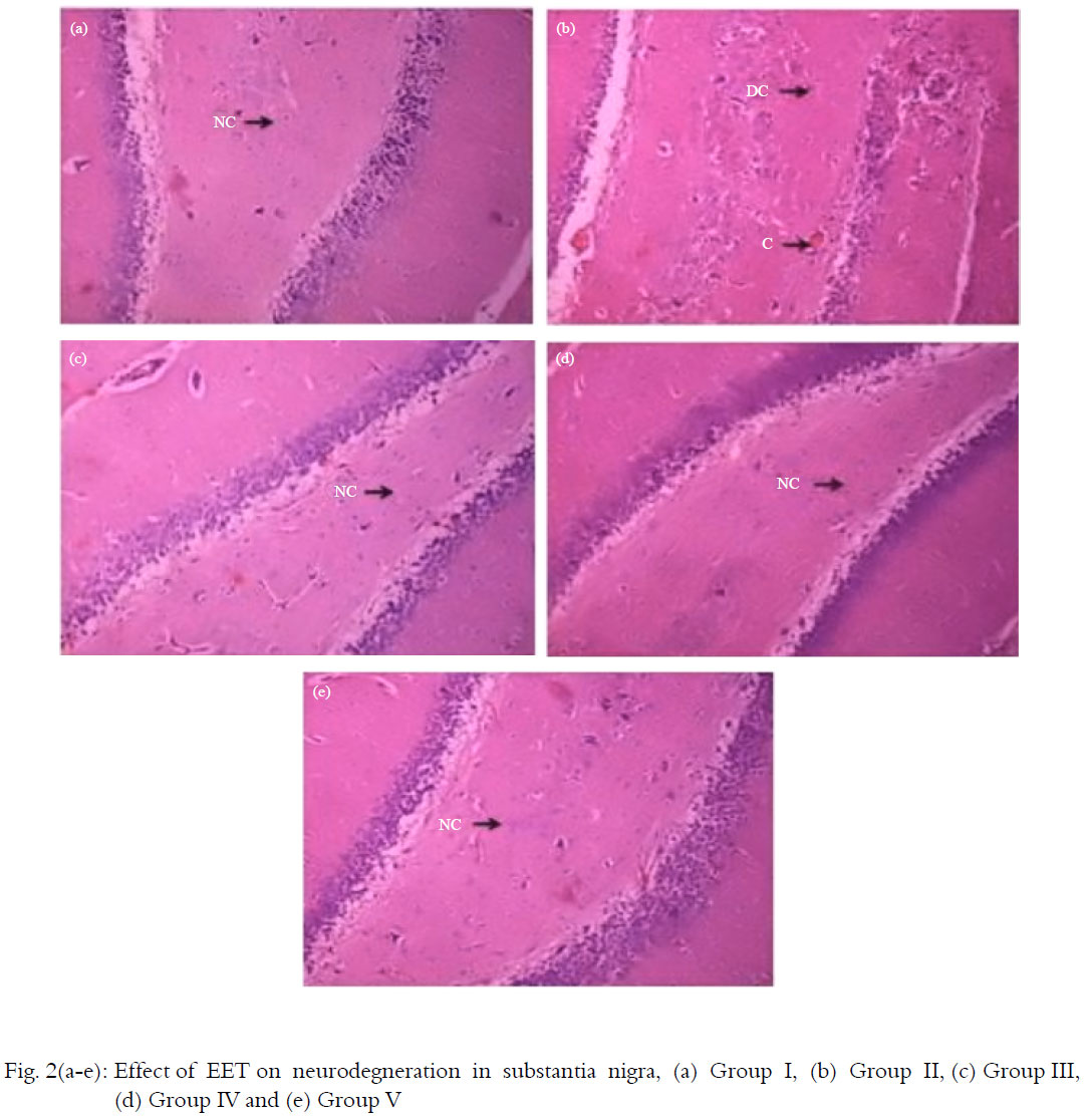 Image for - Neuroprotective Activity of Tephrosia purpurea against Haloperidol Induced Parkinson’s Disease Model