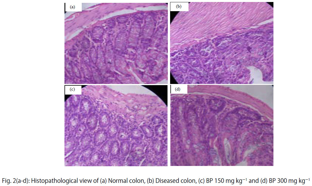 Image for - Protective Effect of n-butylidenephthalide Against 1, 2-dimethylhydrazine Induced Colon Cancer in Mice