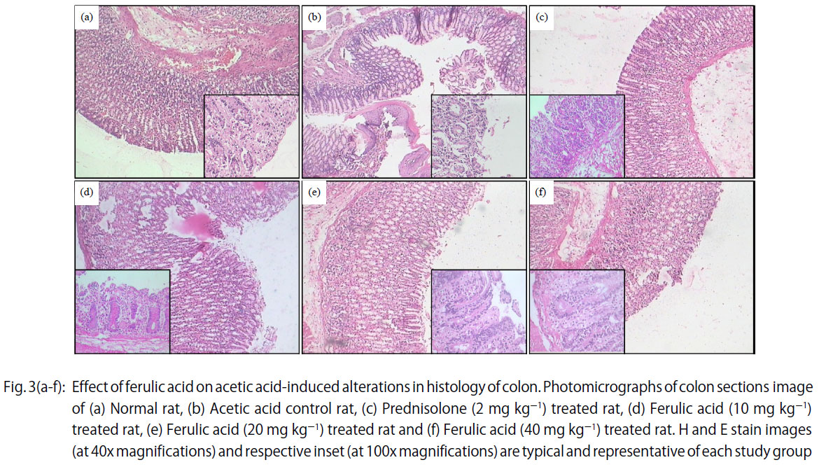 Image for - Ameliorative Effect of Ferulic Acid Against Acetic Acid Induced Ulcerative Colitis: Role of HO-1 and Nrf2