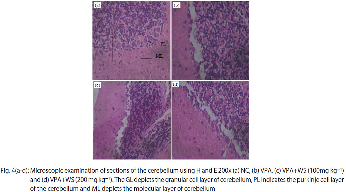 Image for - Withania somnifera Ameliorates Sodium Valproate Induced Austism in BALB/c Mice: Behavioral and Biochemical Evidences