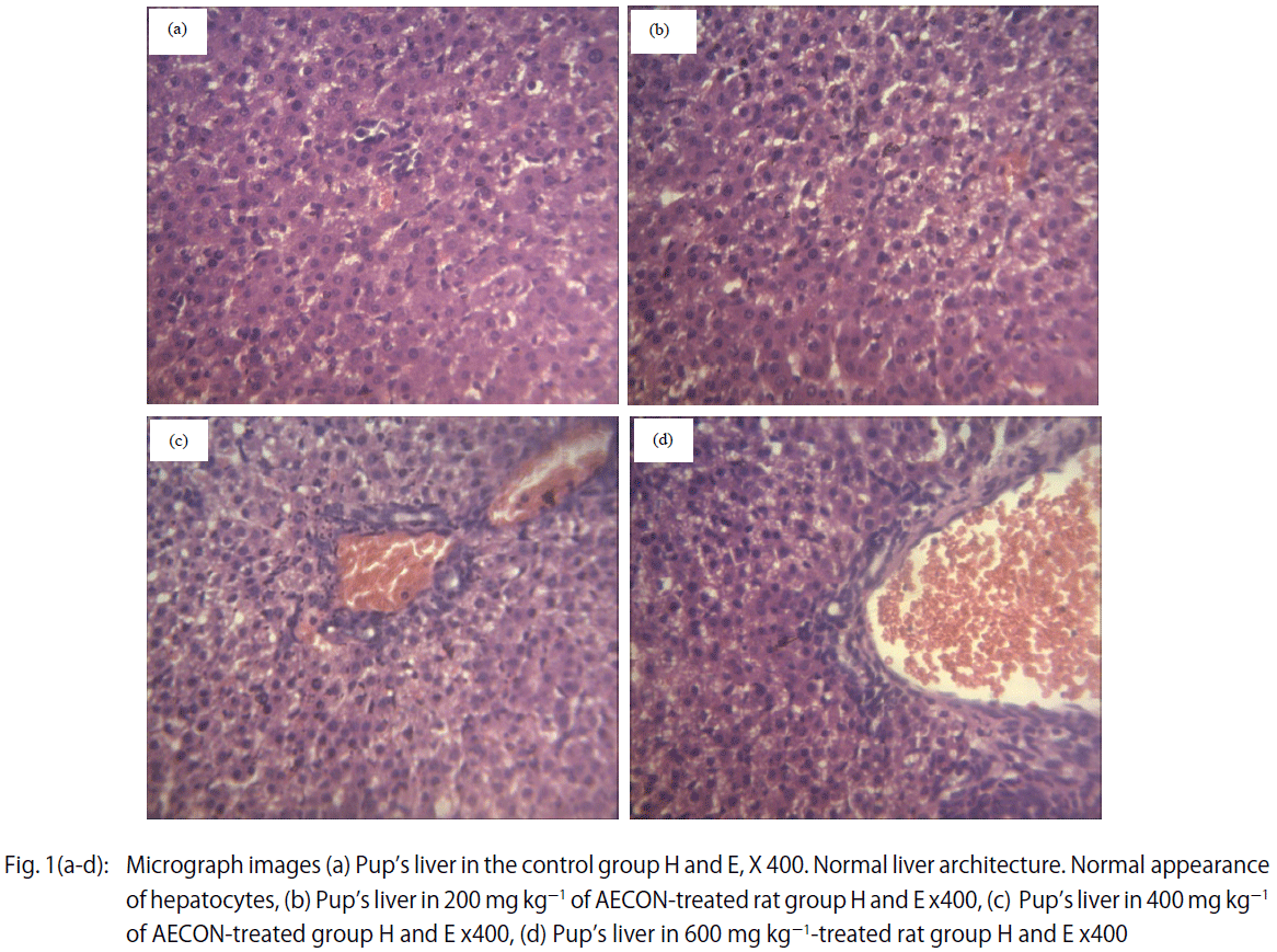Image for - Effect of Aqueous Extract of Kola nitida on the Development of Biliary Atresia in Pups of Wistar Rats