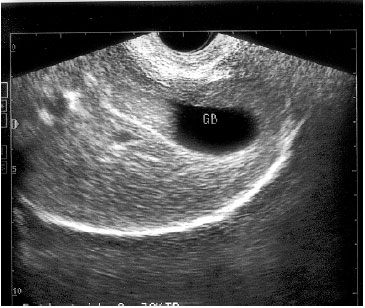 Image for - Prevalence of Cholecystic Diseases in Dogs: An Ultrasonographic Evaluation
