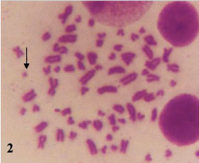 Image for - Preliminarily Studies on Chromosomal Abnormalities and Sister Chromatid Exchanges Associated with Trypanosomosis in Relation to Male Camel Fertility