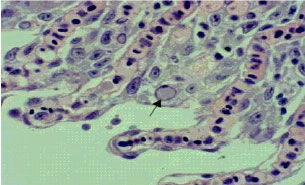 Image for - The First Report of Spring Viraemia of Carp in Some Rainbow Trout Propagation and Breeding by Pathology and Molecular Techniques in Iran