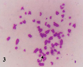 Image for - Preliminarily Studies on Chromosomal Abnormalities and Sister Chromatid Exchanges Associated with Trypanosomosis in Relation to Male Camel Fertility