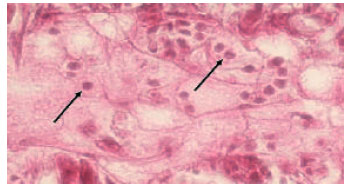 Image for - Gross Sign, Histopathology and Polymerase Chain Reaction Observations of White Spot Syndrome Virus in Shrimp Specific Pathogen Free Litopeneaus vannamei in Iran