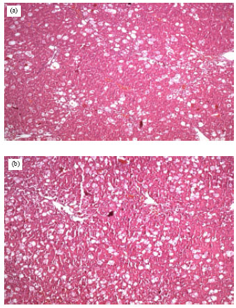 Image for - The Effects of Diethylether Extract of Helichrysum plicatum Dc. Subsp. Plicatum and tanacetum balsamita L. Subsp. Balsamitoides (Sch. Bip.) Grierson (Asteraceae) on the Acute Liver Toxicity in Rats