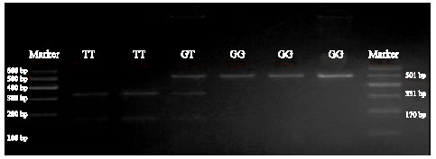 Image for - The Polymorphism of a Novel Mutation of KAP13.1 Gene and its  Associations with Cashmere Traits on Xinjiang Local Goat Breed in China
