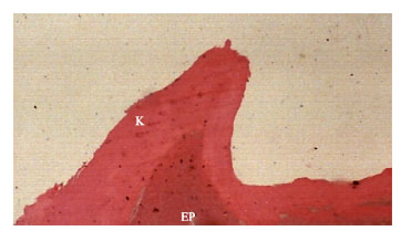 Image for - A Microscopic Study of lingual Papillae in Iranian Buffalo (Bubalus bubalus)