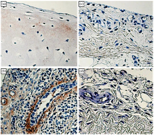 Image for - Differential Expression of Immuno-inflammatory Genes in Synovial Cells from Knee after Inducing Post-traumatic Arthritis in Swine