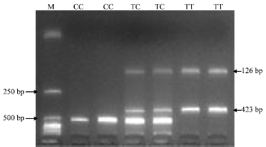 Image for - Polymorphism Identification and Association with Cytokine Traits of IRF7 Gene in Three Pig Breeds