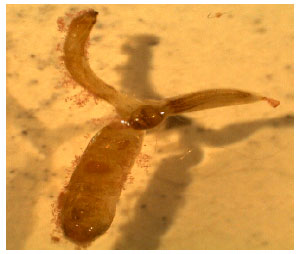 Image for - First Report of Tracheliastes polycolpus (Copepoda: Lernaeopodidae) and  Piscicola geometra   L.   1761   (Annelida-hirudinea)   on Capoeta umbla at Murat River, Turkey