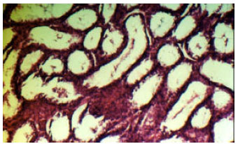 Image for - The Testicular Pathologies in Rams of the Algerian Local Breed “Rembi” Clinical and Histopathological Classification