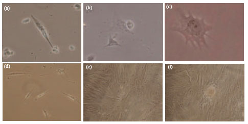 Image for - Multipotent Differentiation Potential of Buffalo Adipose Tissue Derived Mesenchymal Stem Cells