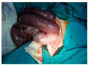 Image for - Double Intussusception in Dog