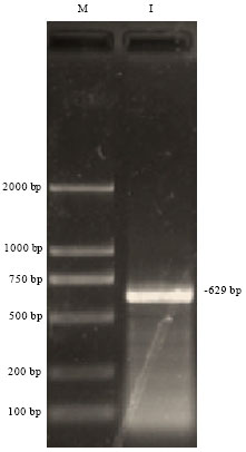 Image for - cDNA Cloning and Analysis of Polymorphism of RERG Gene in QianBei Ma Goat