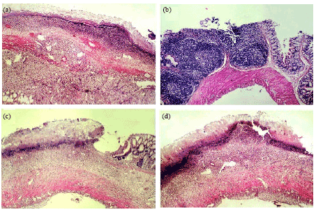 Image for - Better Efficacy of Lactobacillus casei in Combination with Bifidobacterium bifidum or Saccharomyces boulardii in Recovery of Inflammatory Markers of Colitis in Rat
