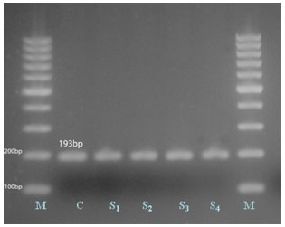 Image for - PCR and Serological Assays for Detection of Toxoplasma Gondii Infection in Sport Horses in Cairo, Egypt