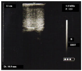 Image for - Evaluation of Testicular Measurement and Sperm Production of Tunisian Arab Stallions using Ultrasonography