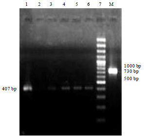 Image for - ELISA and RT-PCR Based Detection of Bovine Coronavirus in Northern India
