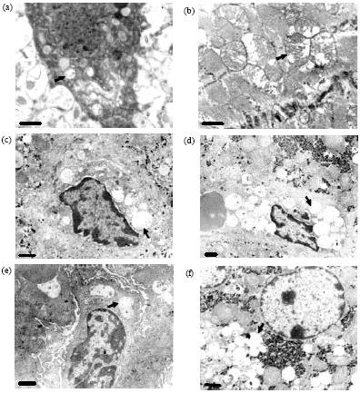 Image for - Isolation and Identification of Swainsonine from Oxytropis glabra and its Pathological Lesions to SD Rats