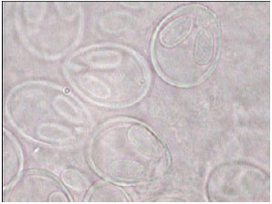 Image for - Protozoan and Myxozoan Infections in Some Fishes of Parishan Lake