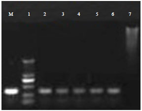 Image for - Detection of Mink (Mustela vison) DNA in Meat Products using Polymerase Chain Reaction PCR Assay