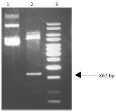 Image for - Application of DsbA Signal Peptide for Soluble Expression of Leishmania infantum P4 Nuclease in E. coli