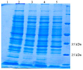 Image for - Application of DsbA Signal Peptide for Soluble Expression of Leishmania infantum P4 Nuclease in E. coli
