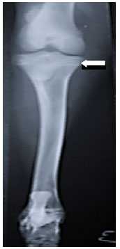 Image for - Determination of the Closure Time of Growth Plates of Tibia-Fibula in Colored Mohair Goat’s Kids by Radiography