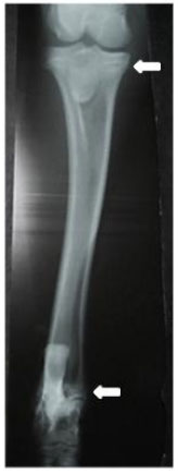 Image for - Determination of the Closure Time of Growth Plates of Tibia-Fibula in Colored Mohair Goat’s Kids by Radiography