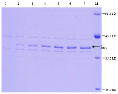 Image for - Cloning, Expression and Purification of Recombinant Envelope Protein VP36A of White Spot Syndrome Virus