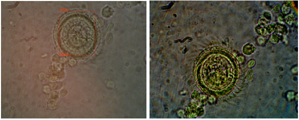 Image for - Protozoan and Myxozoan Infections in Some Fishes of Parishan Lake